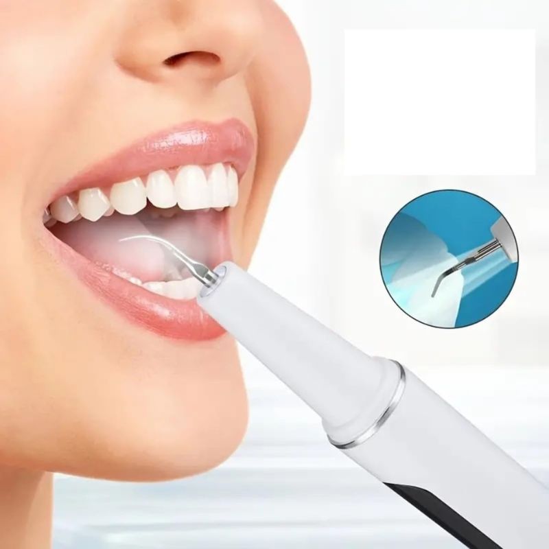 Scaler Dentale ad Ultrasuoni – Pulizia Denti | Igiene Orale