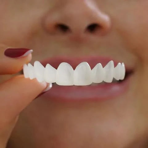 Faccette per denti con finitura bianca naturale