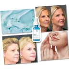 Sérum Hyalu B5 à l’acide hyaluronique – gel anti-âge visage aux bienfaits hydratants et lissants